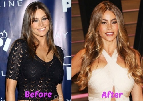 A picture of Sofia Vergara Before (left) and After (right).